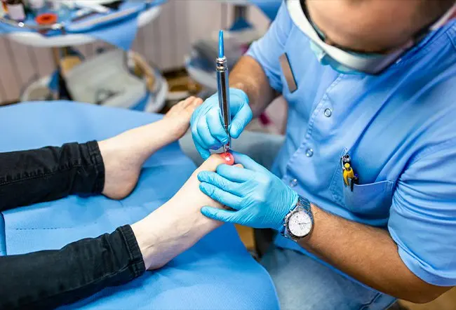 درمان ناخن پا در گوشت