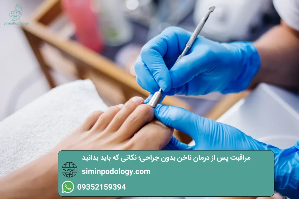 مراقبت پس از درمان ناخن بدون جراحی